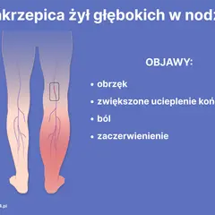 Objawy zaburzeń krzepnięcia krwi: Krwotok czy zakrzep? Sprawdź!