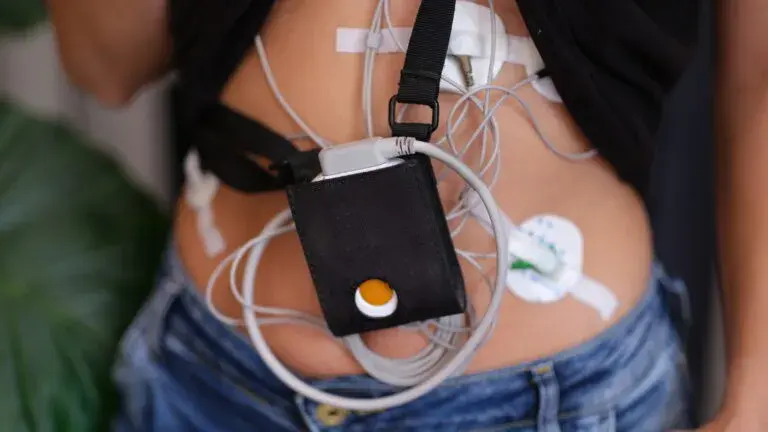 Holter EKG a nerwica: Co naprawdę mówi o Twoim sercu?