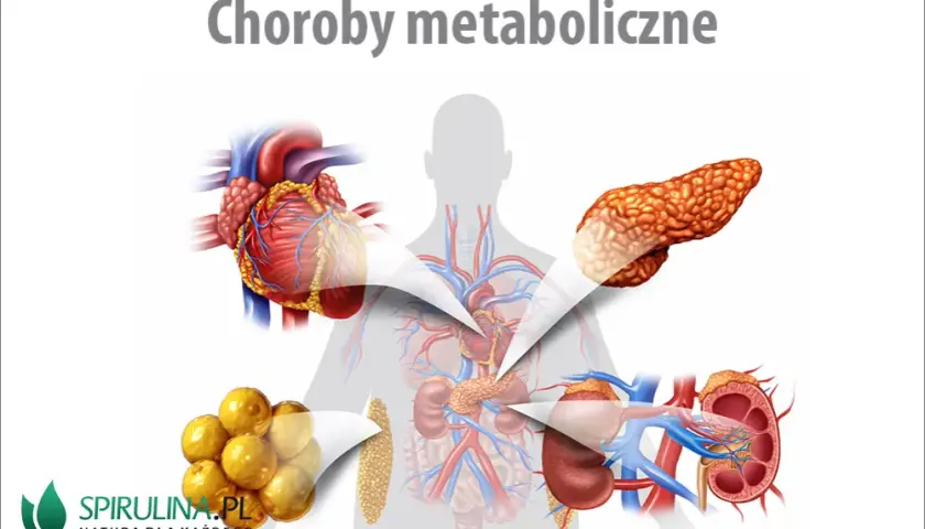 Zaburzenia metaboliczne: objawy, przyczyny i leczenie. Sprawdź, co jeść!