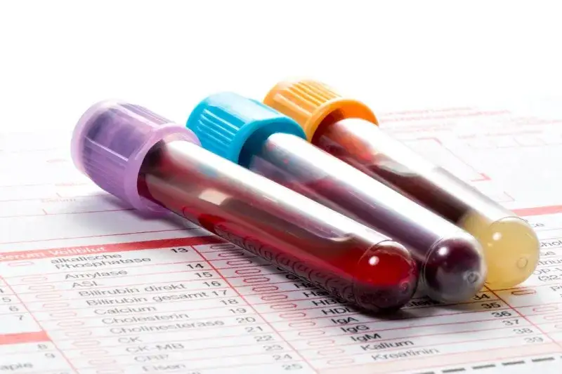 badania krwi diagnostyka metaboliczna